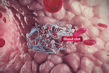 How does aspirin work Animated process