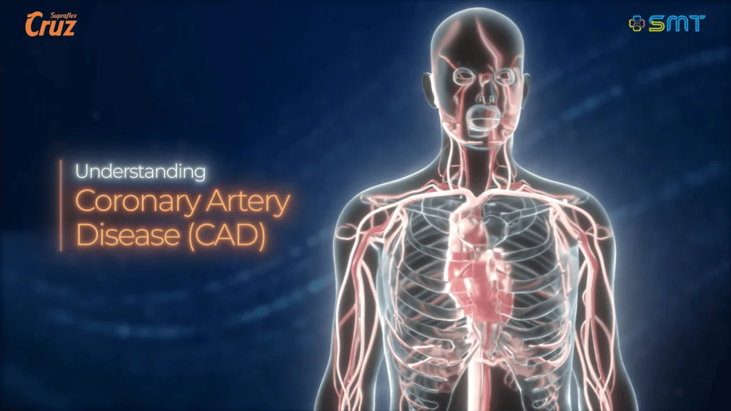 Coronary-Artery-Disease-Animation-Video