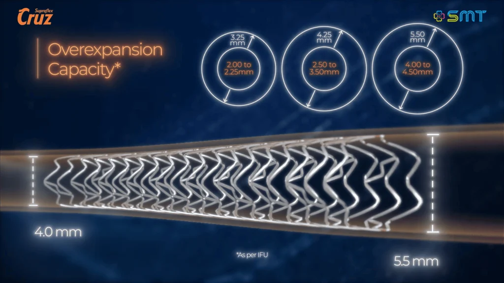 Coronary-Artery-Disease-CAD-Animation